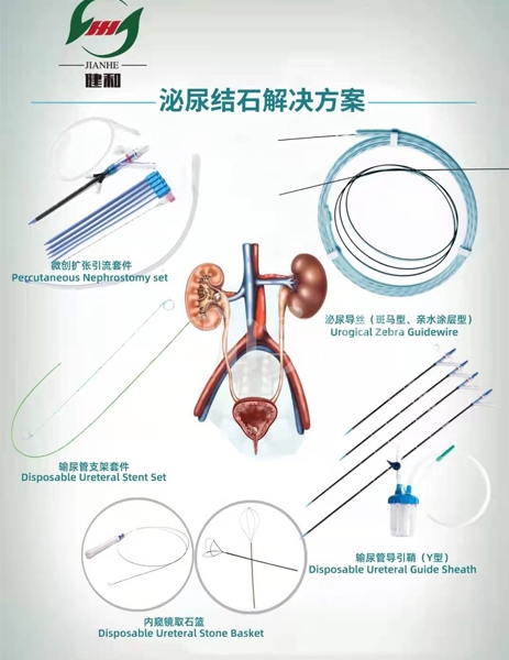 泌尿結(jié)石解決方案